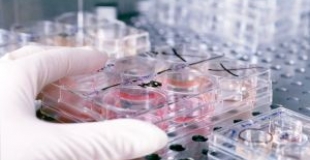 Les tests de paternité et leurs conséquences sur la famille